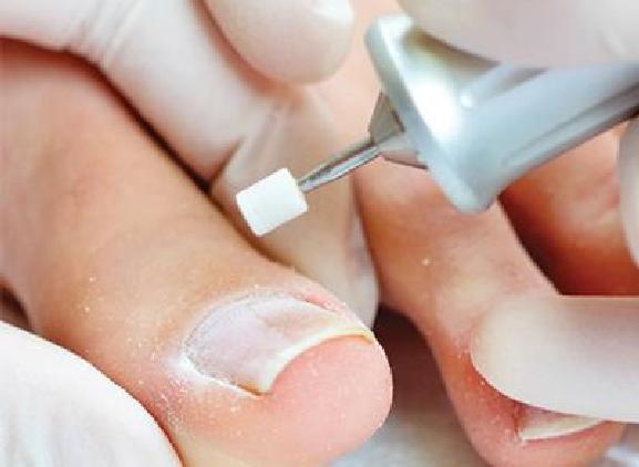 Ontdek onze voetverzorging